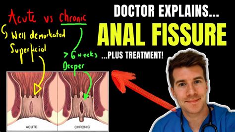 anallecken|Arschlecken und Zungenanal